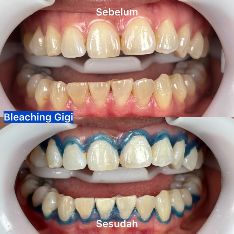 WhatsApp Image 2026-03-20 at 22.18.08