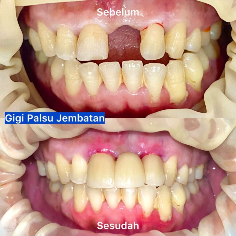 WhatsApp Image 2026-03-20 at 22.18.11