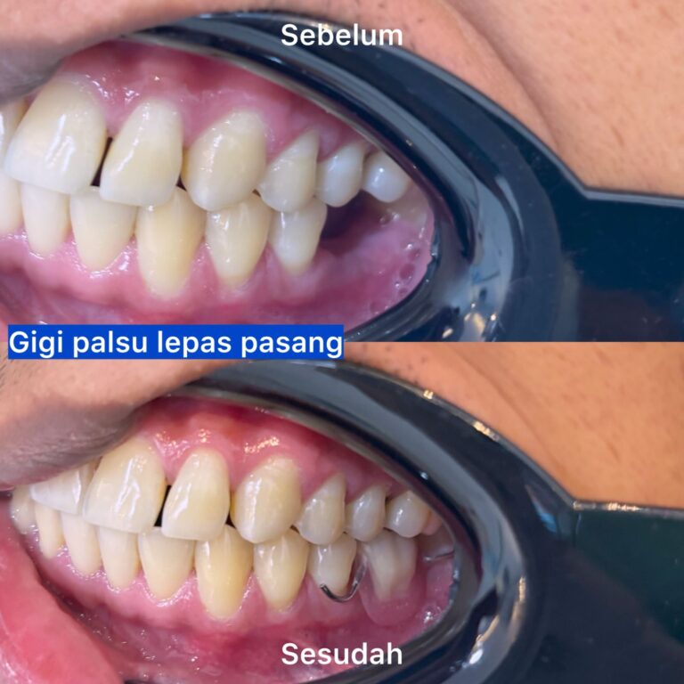 WhatsApp Image 2026-03-20 at 22.18.12