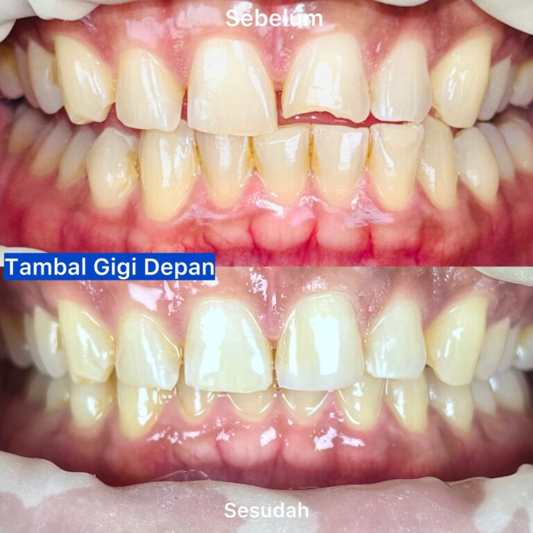 WhatsApp Image 2026-03-20 at 22.18.13